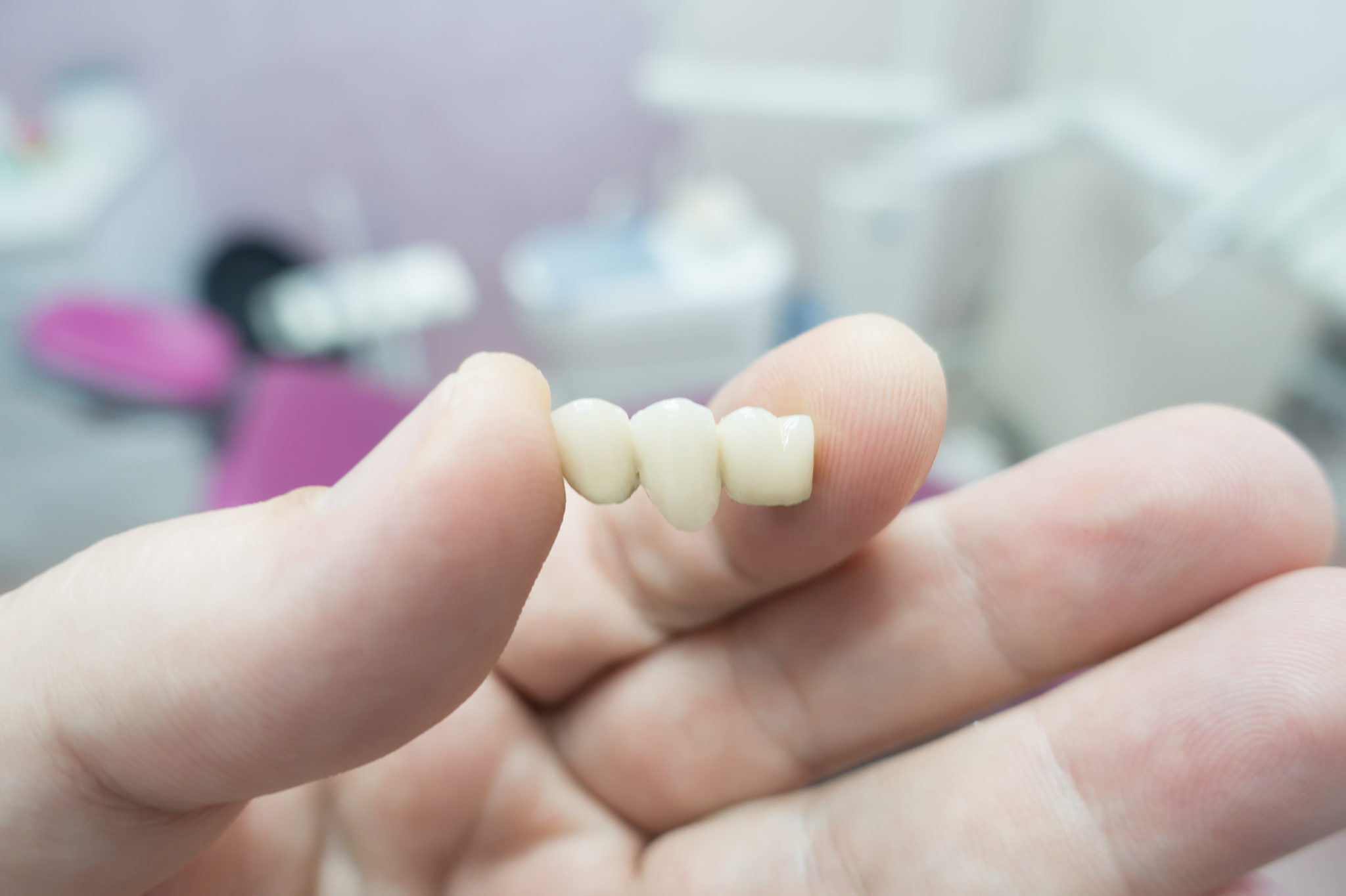 Dental Ceramic Bridge