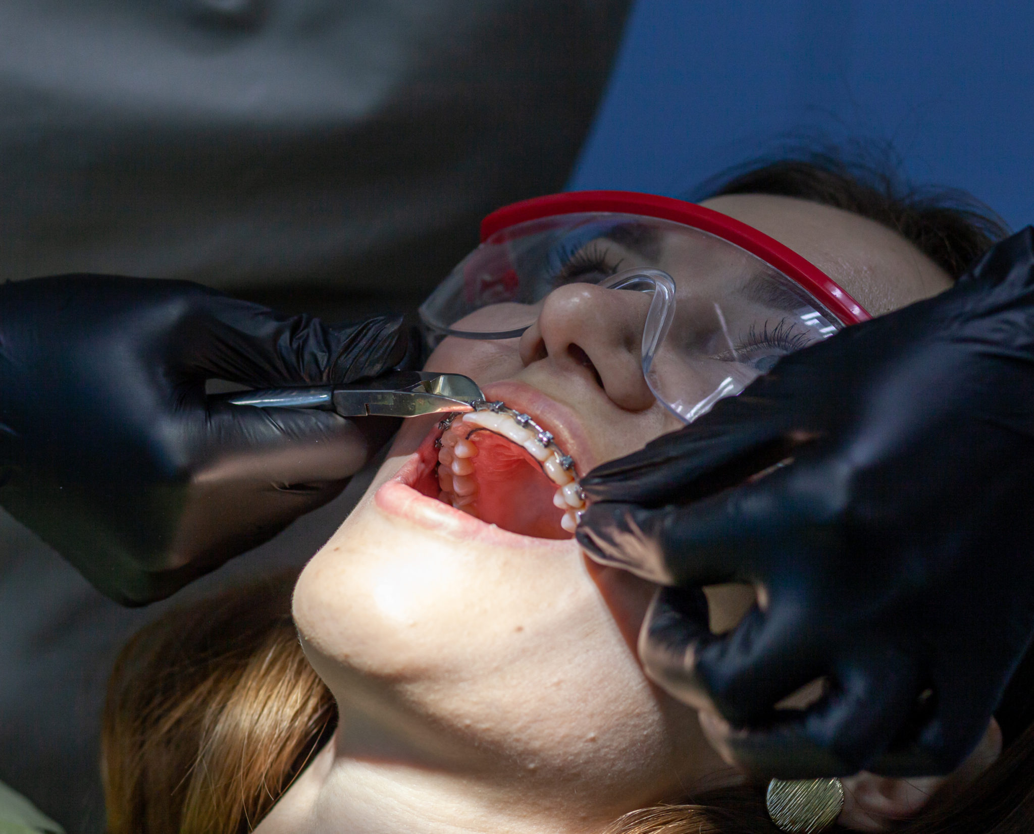 Woman having braces installed